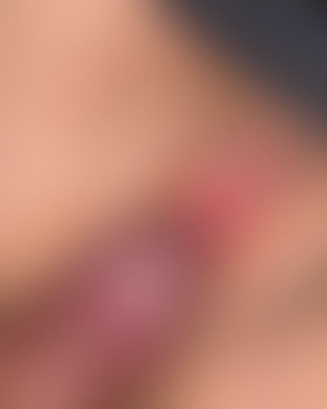 Content thumbnail