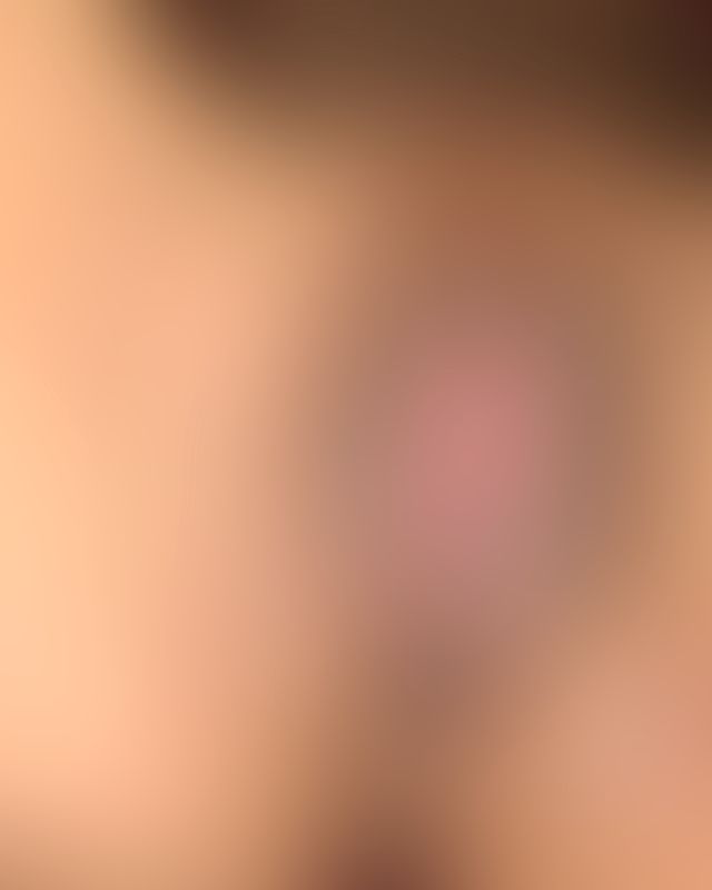 Content thumbnail