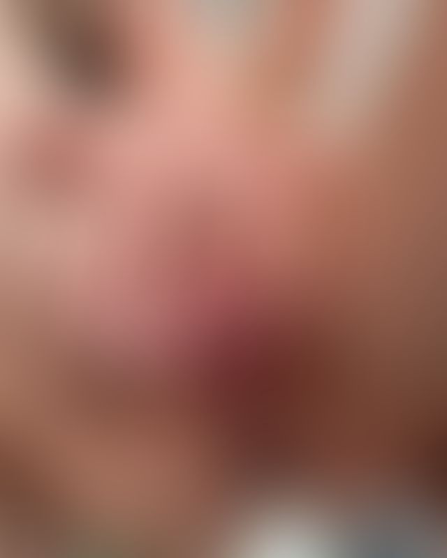 Content thumbnail