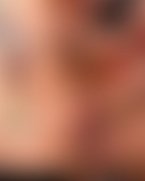 Content thumbnail