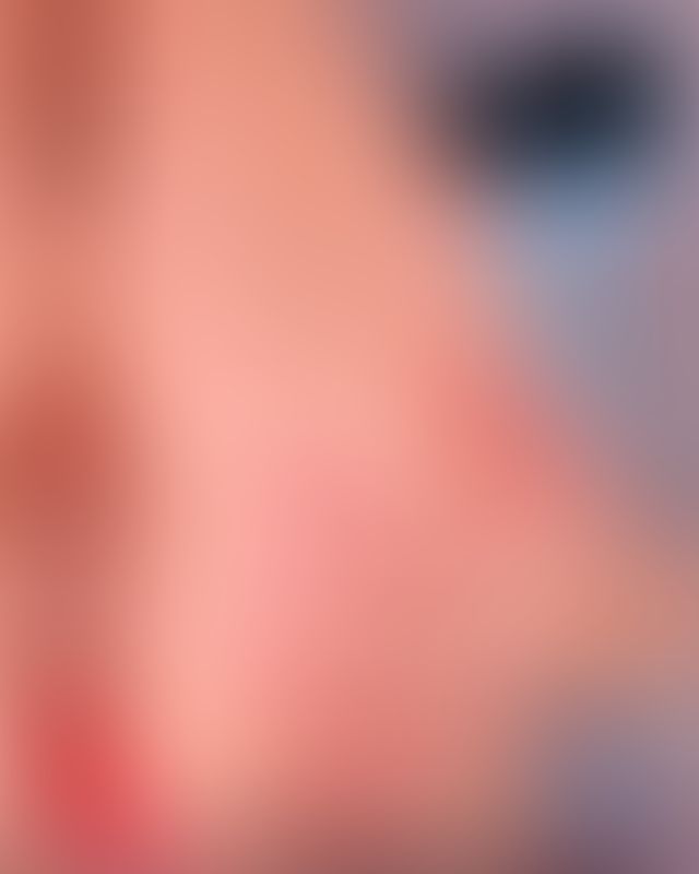 Content thumbnail