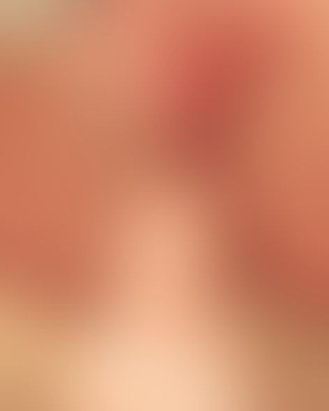 Content thumbnail