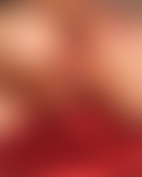 Content thumbnail