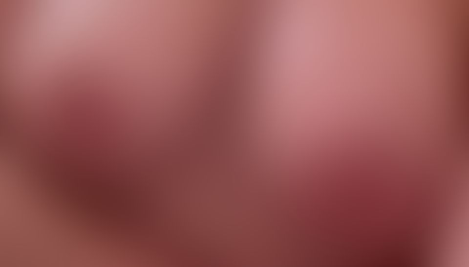 Content thumbnail