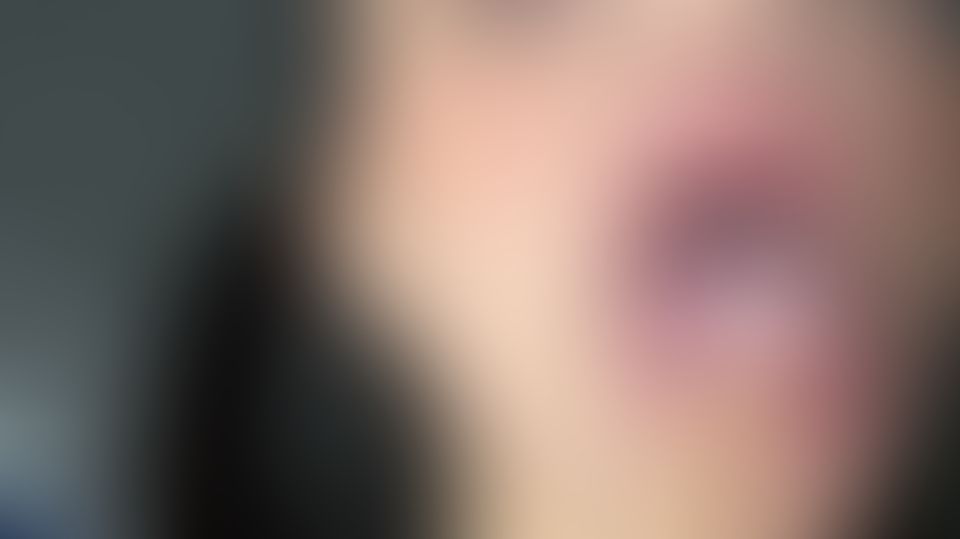 Content thumbnail