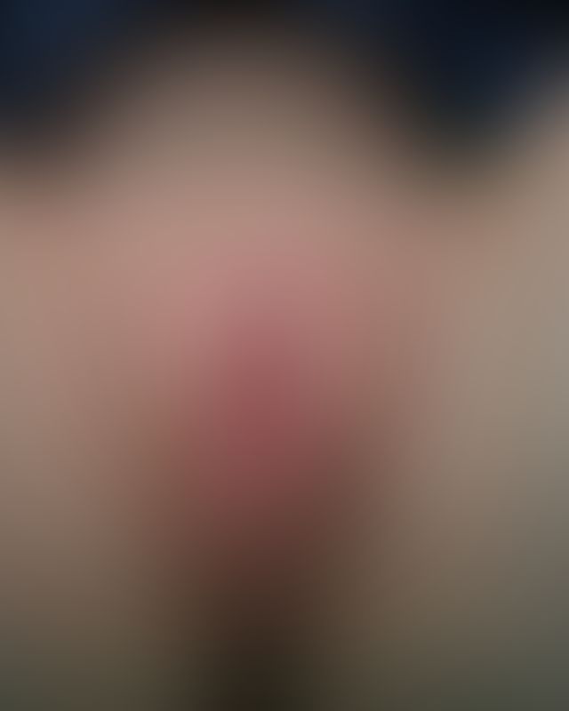 Content thumbnail