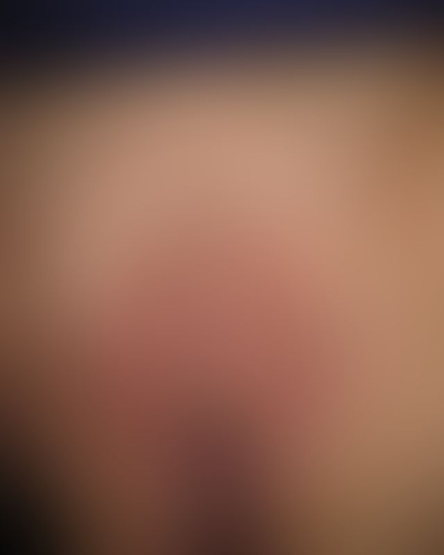 Content thumbnail