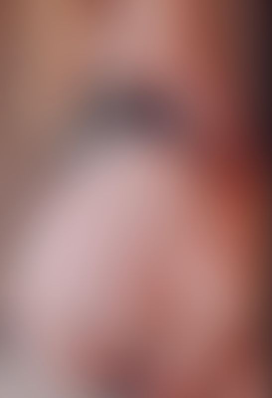 Content thumbnail