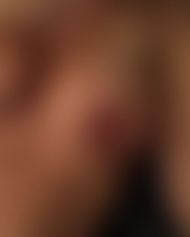 Content thumbnail