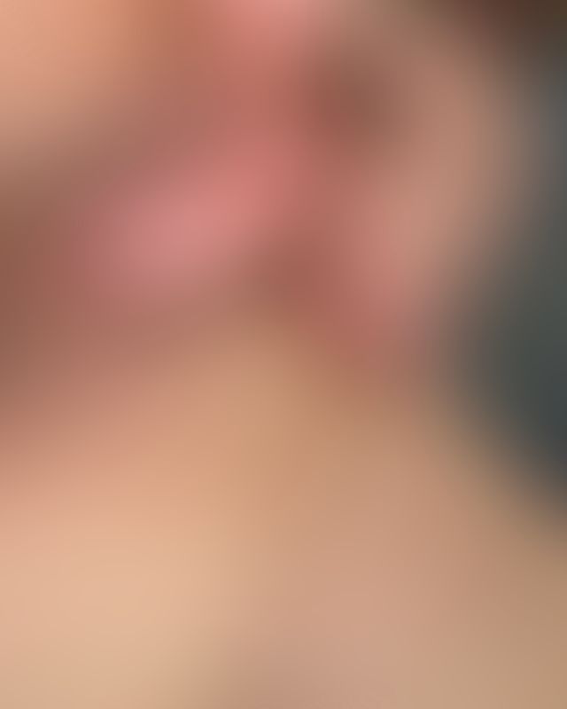 Content thumbnail