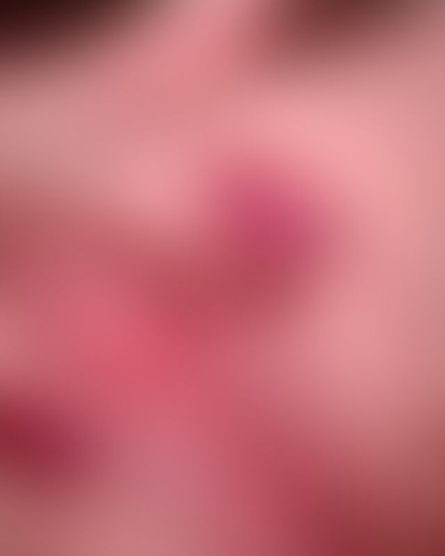 Content thumbnail