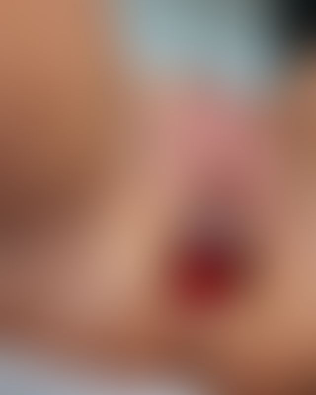 Content thumbnail