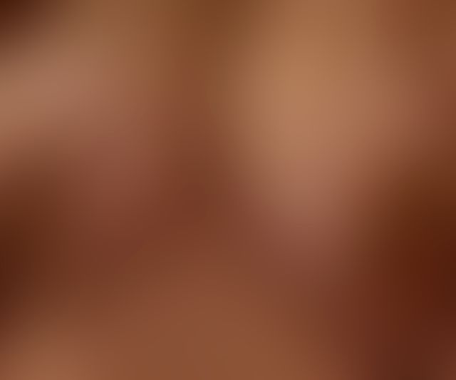 Content thumbnail