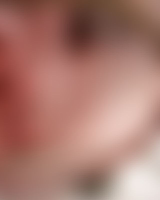 Content thumbnail