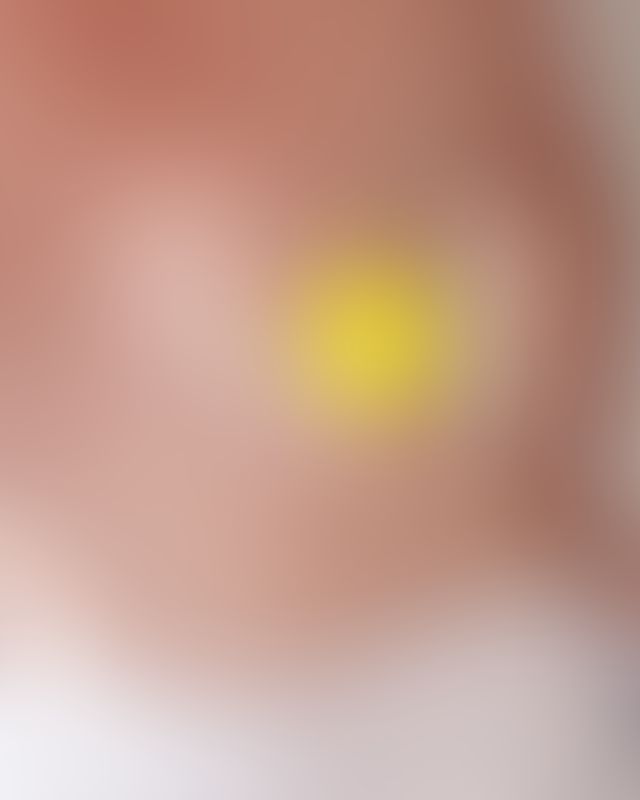 Content thumbnail