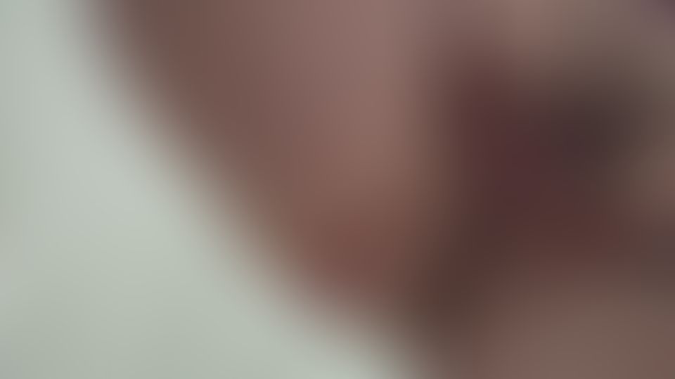Content thumbnail
