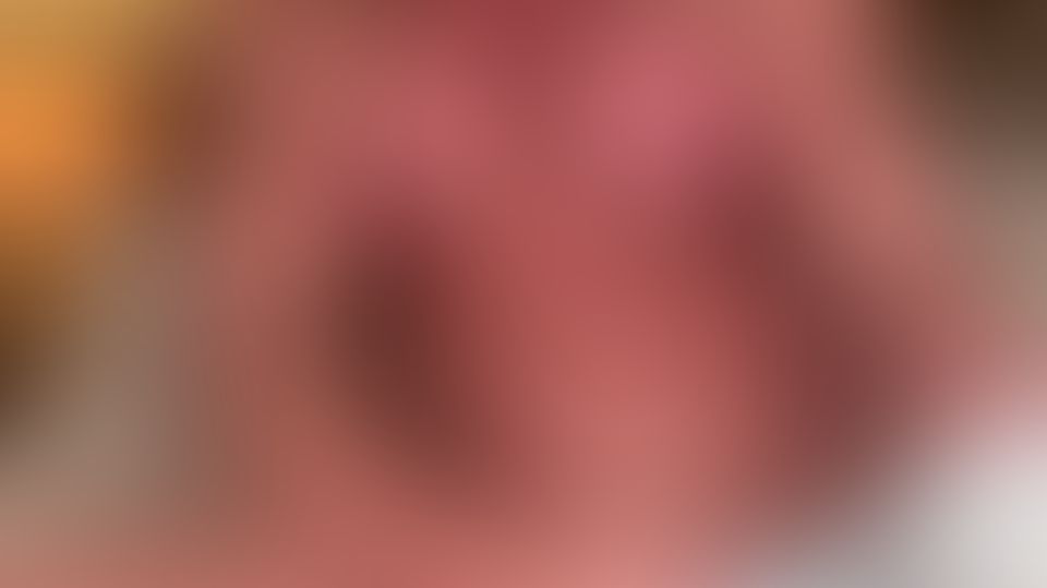 Content thumbnail