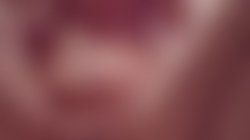 Content thumbnail