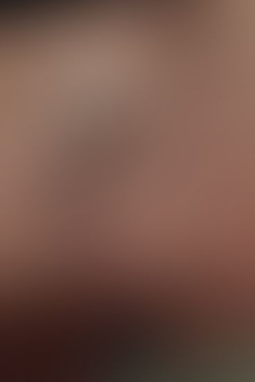 Content thumbnail