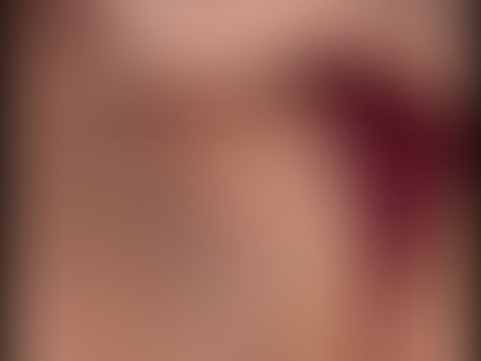 Content thumbnail