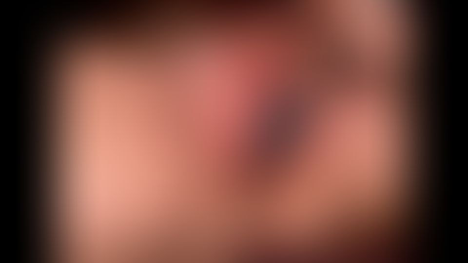 Content thumbnail