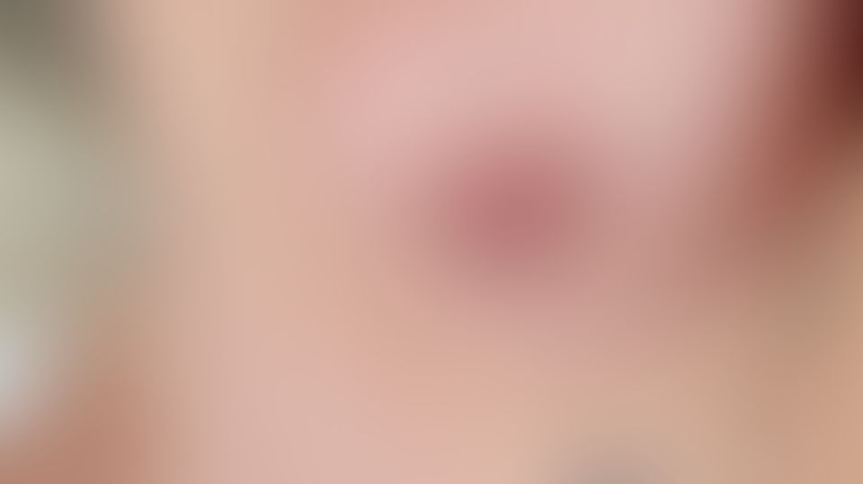 Content thumbnail