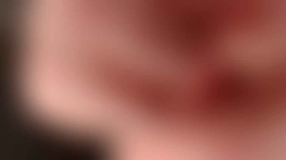 Content thumbnail