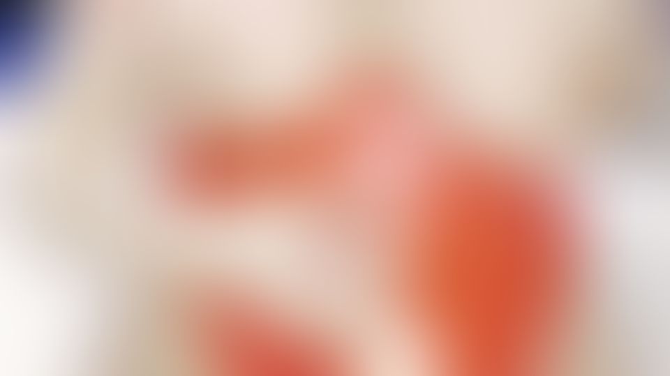 Content thumbnail