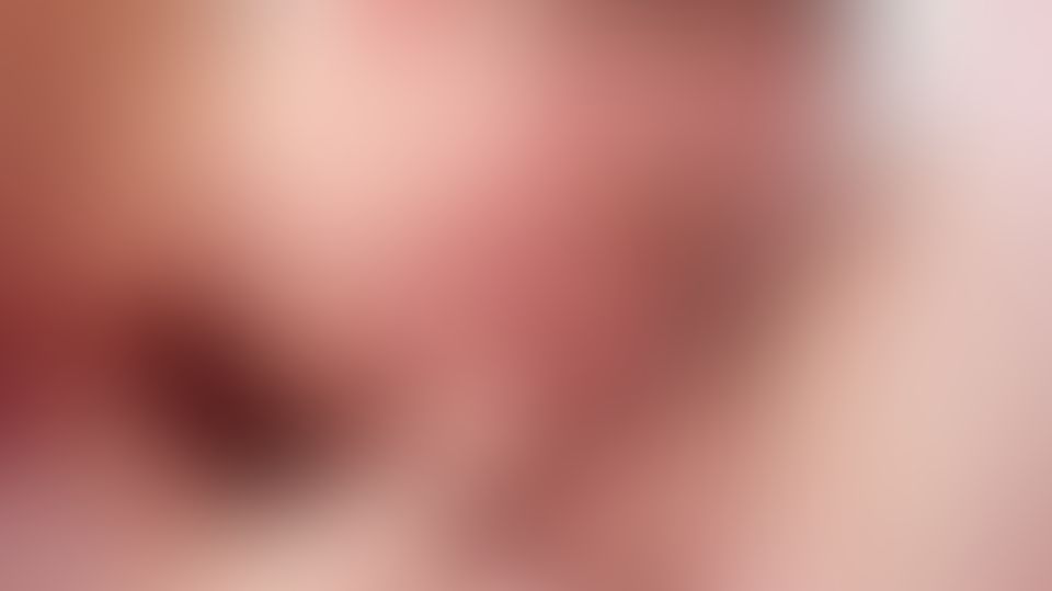 Content thumbnail