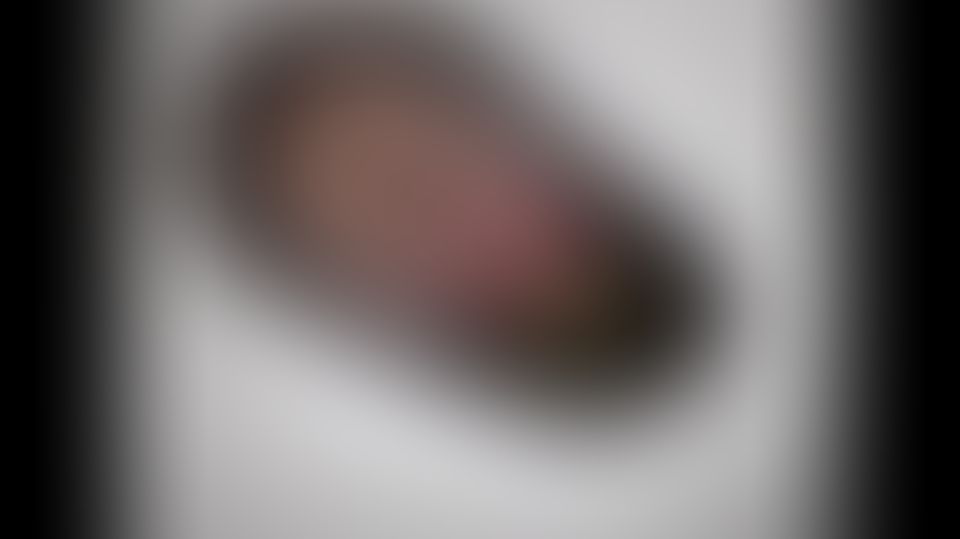 Content thumbnail