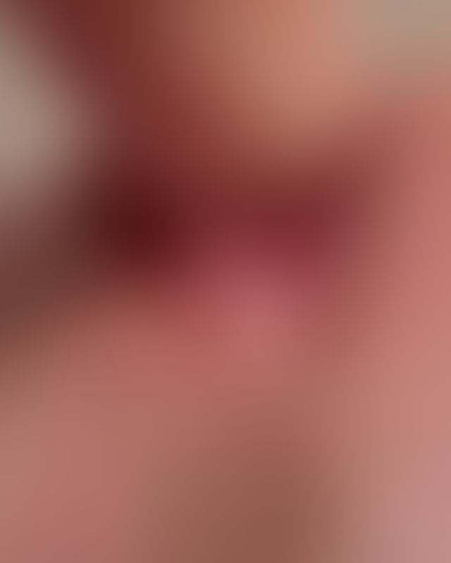 Content thumbnail