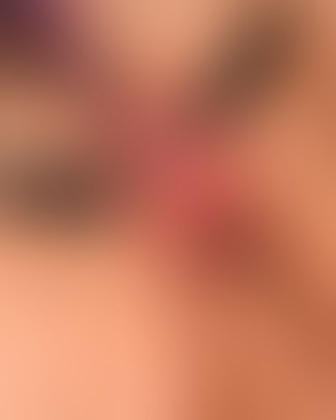 Content thumbnail